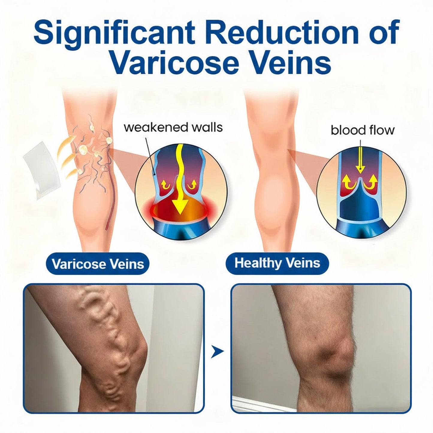 🇺🇸👨‍⚕️ VeinEase Microneedle Care Patch⚡Instant Relief, Long-Term Results