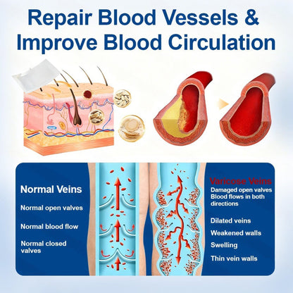 🇺🇸👨‍⚕️ VeinEase Microneedle Care Patch⚡Instant Relief, Long-Term Results