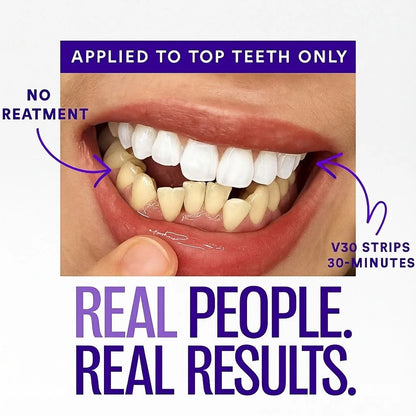 Purple Teeth Whitening Strips | Fast, Gentle & Peroxide-Free Whitening