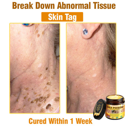 LOVILDS™ Bee Poison All-in-One Cream US Dermatologist Approved